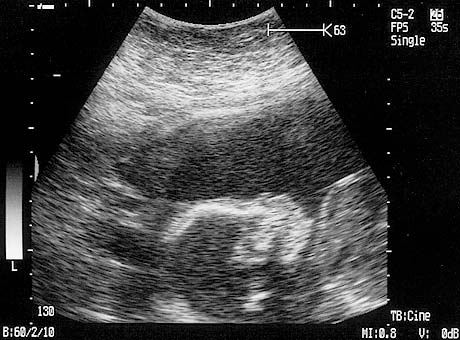 Baby Rockwell August 2006