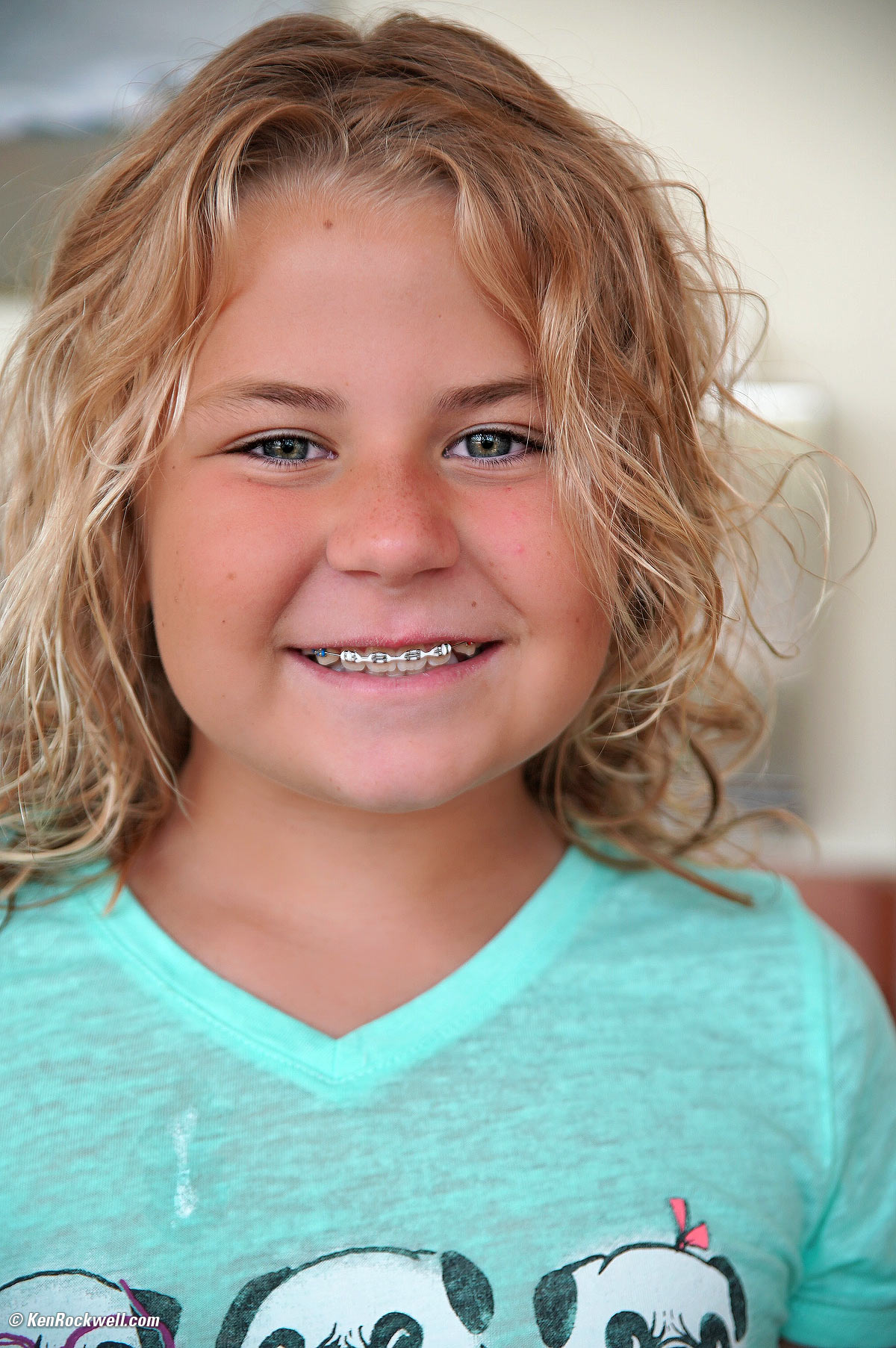 Katie at the orthodontist