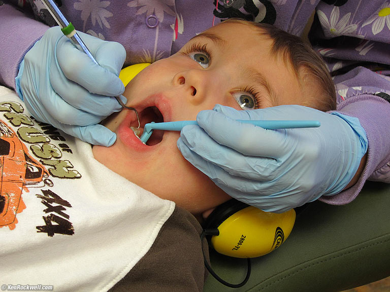 Ryan getting his teeth cleaned