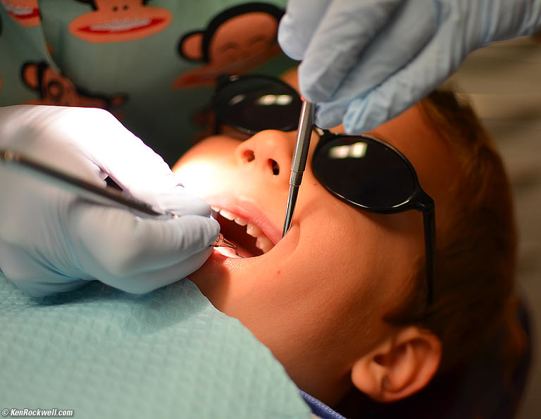 Ryan has his teeth cleaned