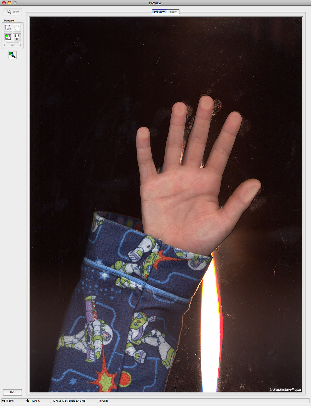 Ryan's Hand in Scanner