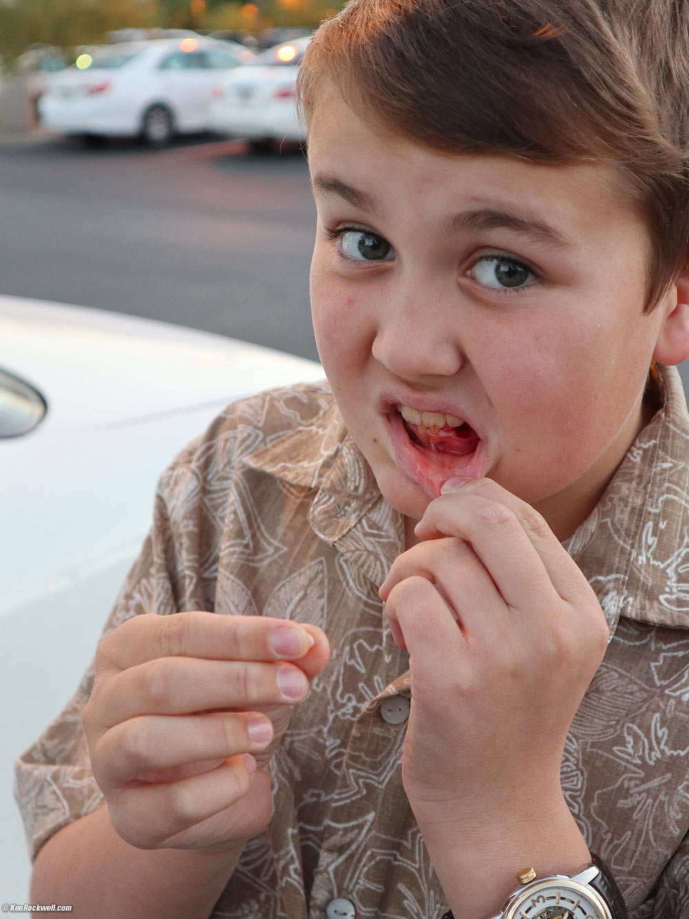 Ryan loses a tooth before dinner