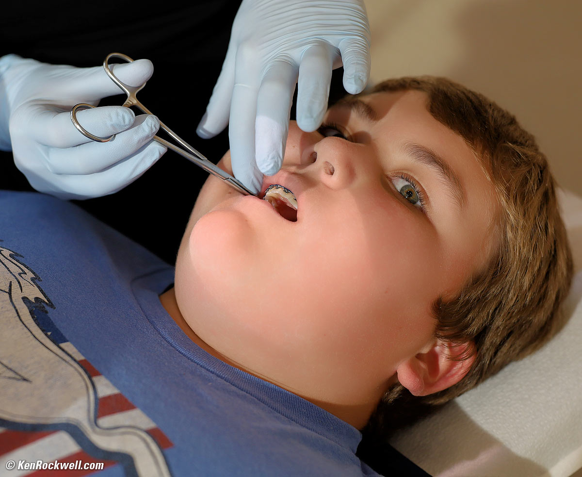Ryan at the Orthodontist